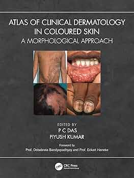 Atlas of Clinical Dermatology in Coloured Skin: A